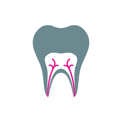 Root Canal: Endodontics