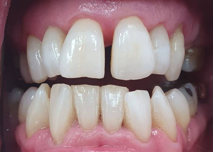 whitening-dental-case-study-after.jpg